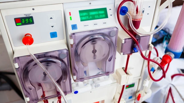 Tratamiento de diálisis peritoneal