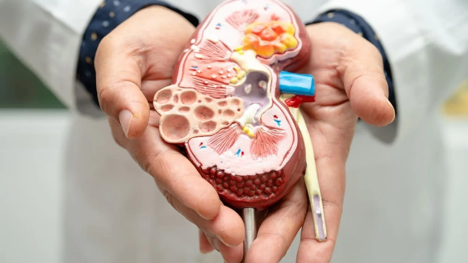 ¿Qué especialista trata la nefritis intersticial?