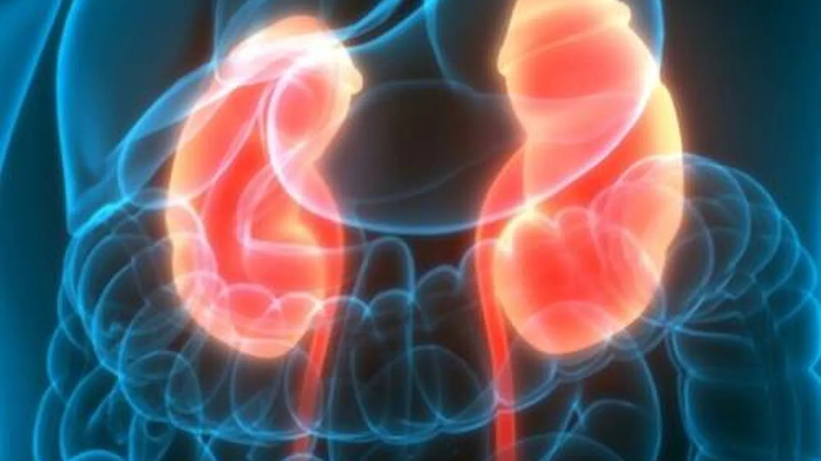 Pielonefritis en CDMX: Manejo integral de la infección renal superior