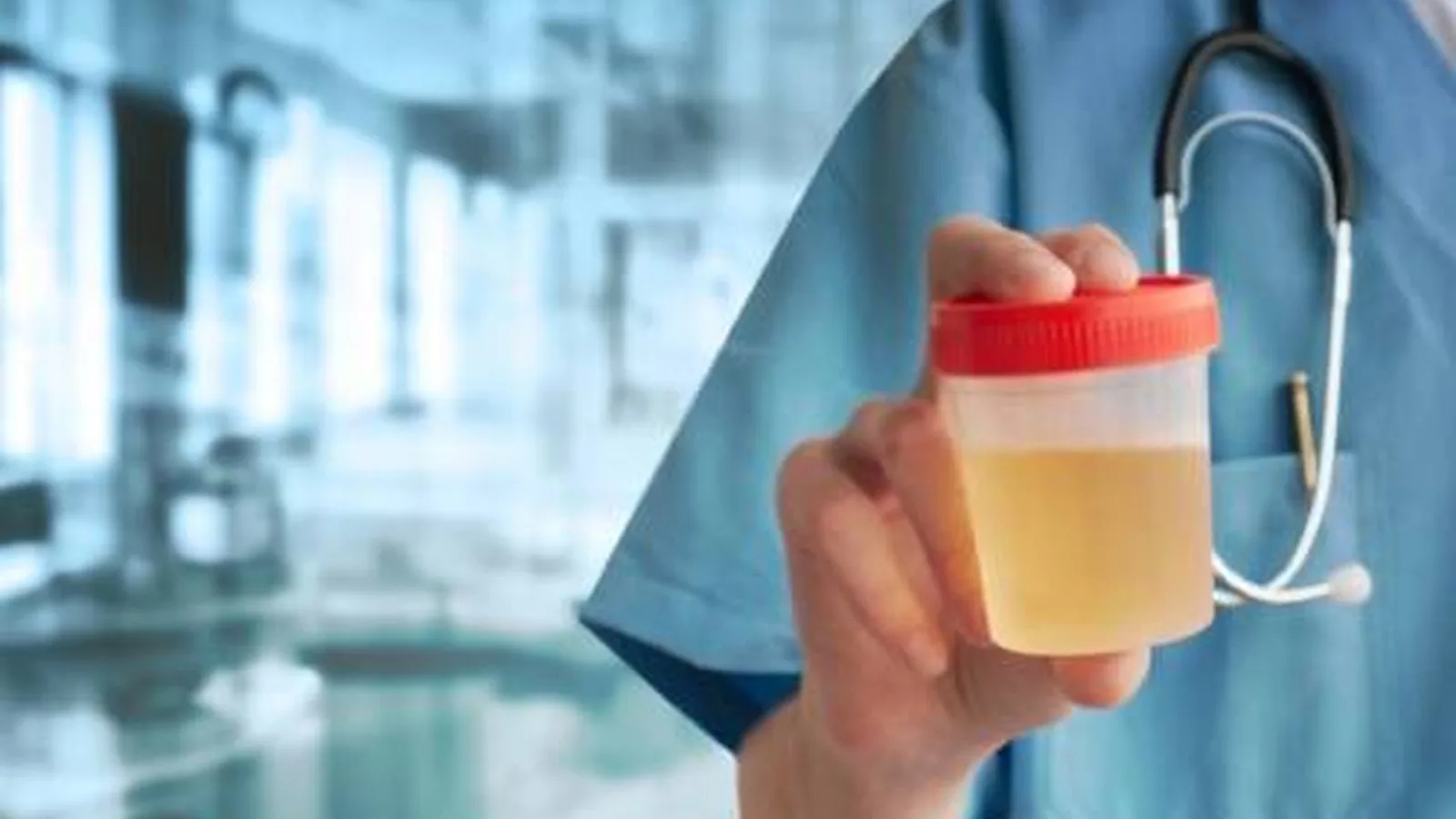 Proteinuria en CDMX: ¿Por qué hay proteínas en su orina?
